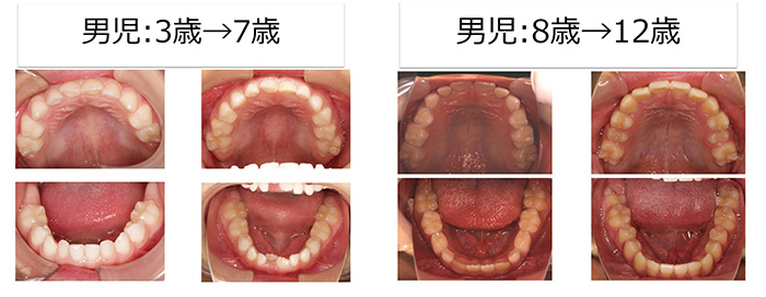 お子様が歯科医院を定期的に受診する目的について