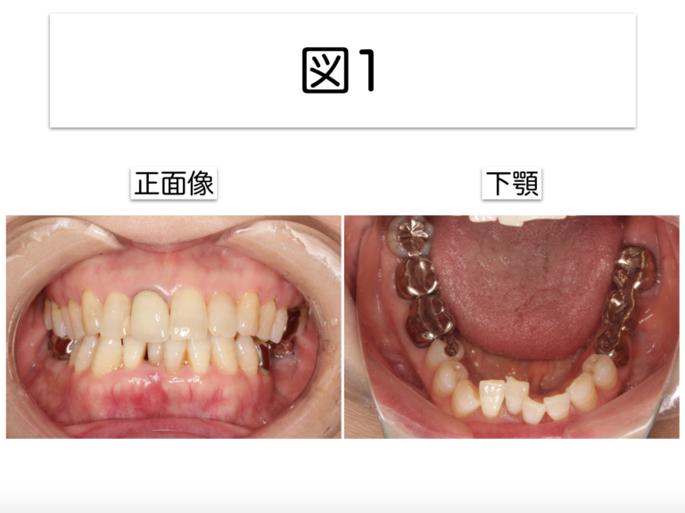 お口の中の病気が、全身に影響を与えていたとしたら？