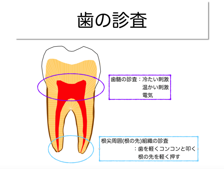 歯髄(歯の神経)は残せるか？残せないか？〜診査診断の大切さ　歯髄壊死編①〜