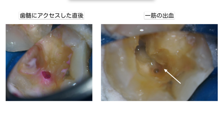 診断