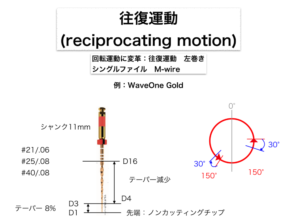 NiTiファイルの歴史編〜ファイルの進化について２〜