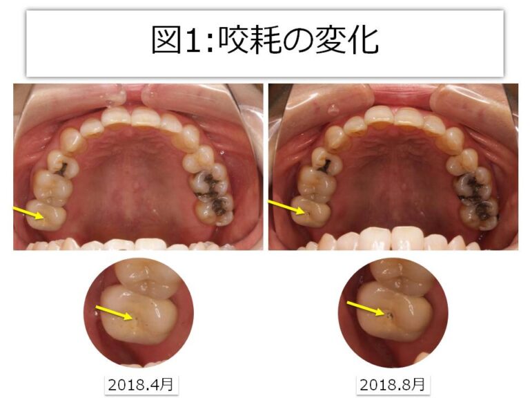 『歯が治った』≠『歯の治療が終わった』～患者さんと歯科医師の意識が合致している編～