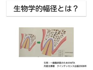 矯正的挺出をなぜ行うか〜生物学的幅径の確保１〜