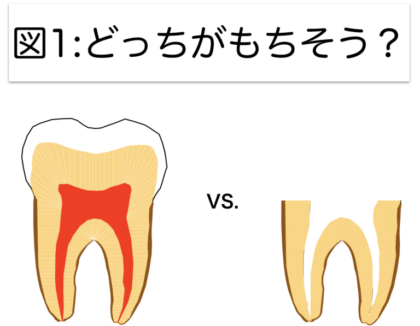 歯をもたせるための、豆知識〜その3 虫歯編①〜