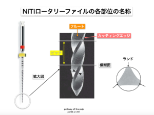 NiTiファイルの各部位について１