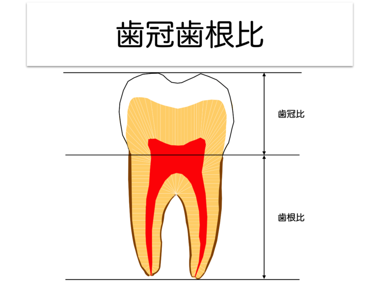 歯冠歯根比