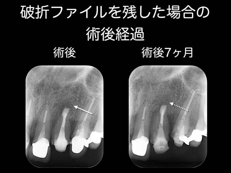 術後7か月